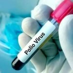 کراچی: ضلع وسطی، غربی، جنوبی اور کورنگی کے ماحولیاتی نمونوں میں پولیو وائرس کی تصدیق