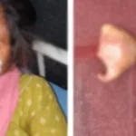 میکے سے واپس نہ آنے پر شوہر نے مبینہ طور پر بیوی کی ناک کاٹ دی